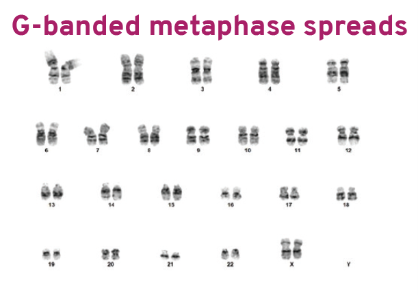 CD34+G banded metaphase spreads